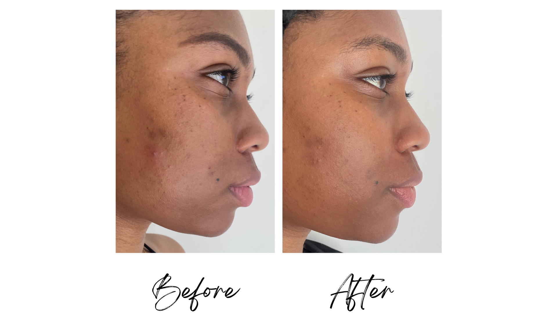 Bright Side – Free + True Skincare